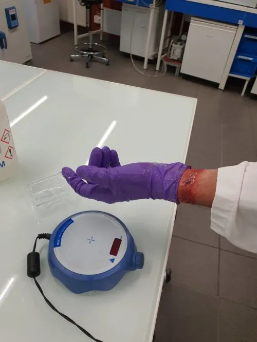 Employee contamination due to a chemical risk